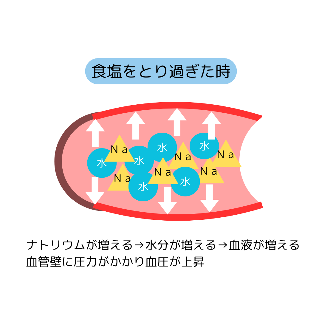 高血圧時の血管の様子
